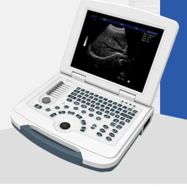Mindray DP-50 - Image 3