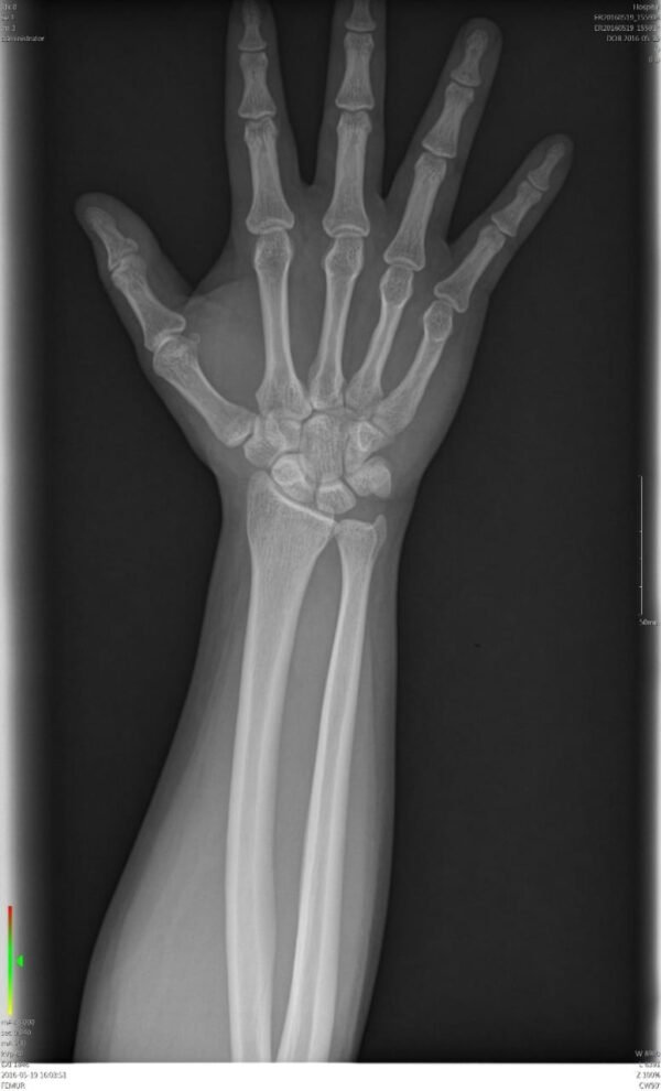 Radiographie numérique mobile - Image 3