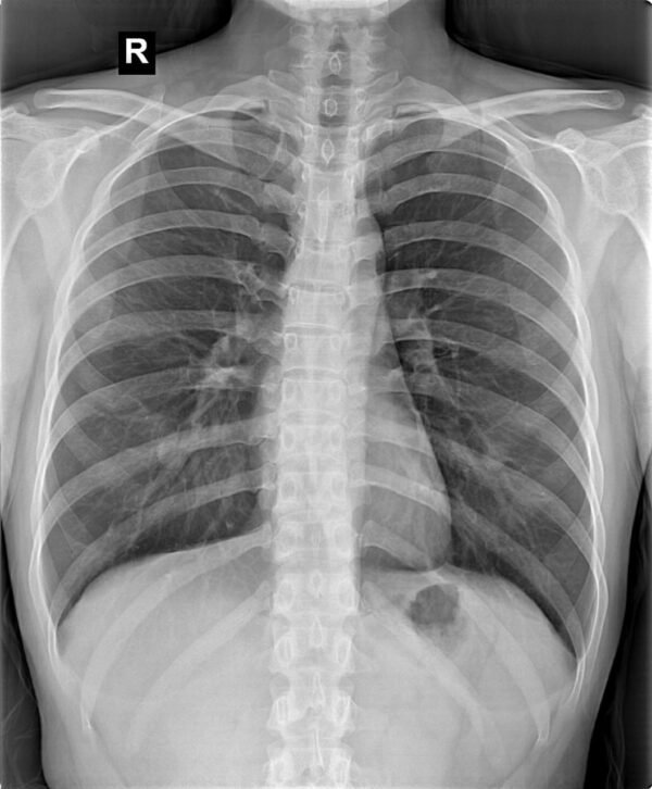 Radiographie numérique mobile - Image 6